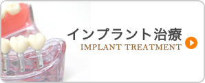 インプラント治療